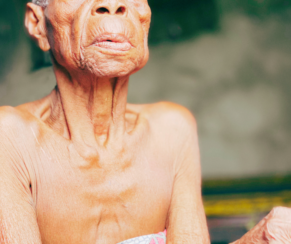 Pessoa idosa com desnutrição